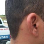 Homem é preso após agredir enfermeiro no hospital Cosme e Silva