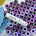 Roraima registra 293 casos de covid-19 e 10 mortes nas últimas 24 horas