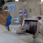 Mais cinco mortes por covid-19 são registradas em RR