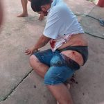 Comerciante é baleado durante assalto na Vila São Silvestre
