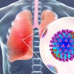 Sesau registra primeiro caso de gripe H3N2 em Roraima