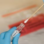 Roraima registra mais 725 casos de Covid-19; 652 foram em Boa Vista
