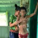 Novas imagens mostram desnutrição e abandono a Povo Yanomami em Roraima