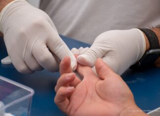 Roraima reduz mortes por aids em 43,7% entre 2023 e 2024