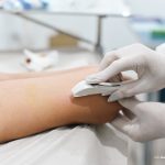 Prefeitura amplia oferta do implante contraceptivo Implanon na rede básica de saúde