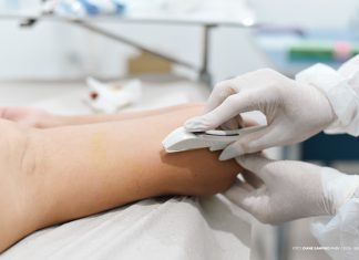 Prefeitura amplia oferta do implante contraceptivo Implanon na rede básica de saúde