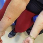 Servidores denunciam agressões de adolescente envolvida em morte de cuidadora no Abrigo Feminino da Setrabes Servidores de abrigo feminino denunciam agressões de adolescente - Foto: Arquivo pessoal