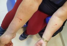 Servidores denunciam agressões de adolescente e falta do pagameto de insalubridade no Abrigo Feminino da Setrabes Servidores de abrigo feminino denunciam agressões de adolescente - Foto: Arquivo pessoal