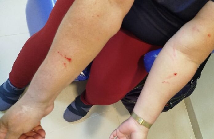 Servidores de abrigo feminino denunciam agressões de adolescente - Foto: Arquivo pessoal