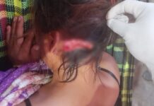 Garota é procurada após denúncia de agressão e desaparecimento em comunidade indígena de Bonfim garota