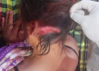 Garota é procurada após denúncia de agressão e desaparecimento em comunidade indígena de Bonfim garota