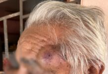 Idoso de 84 anos é esfaqueado seis vezes durante assalto em Caracaraí Idoso de 84 anos é esfaqueado seis vezes durante assalto em Caracaraí