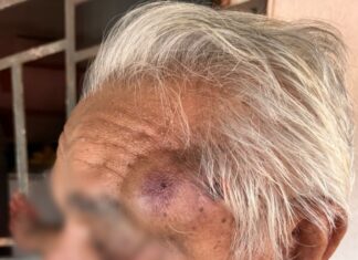 Idoso de 84 anos é esfaqueado seis vezes durante assalto em Caracaraí Idoso de 84 anos é esfaqueado seis vezes durante assalto em Caracaraí
