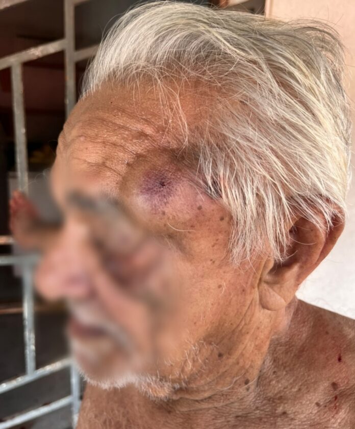 Idoso de 84 anos é esfaqueado seis vezes durante assalto em Caracaraí
