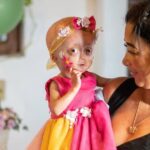 Elis, uma das gêmeas de RR com síndrome de envelhecimento precoce, morre aos 5 anos Elis, uma das gêmeas de RR com síndrome de envelhecimento precoce, morre aos 5 anos