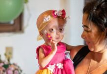 Elis, uma das gêmeas de RR com síndrome de envelhecimento precoce, morre aos 5 anos Elis, uma das gêmeas de RR com síndrome de envelhecimento precoce, morre aos 5 anos