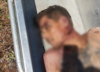 Jovem é encontrado morto com perfurações no pescoço e abdômen em terreno baldio do bairro Pricumã Jovem é encontrado morto com perfurações no pescoço e abdômen em terreno baldio do bairro Pricumã